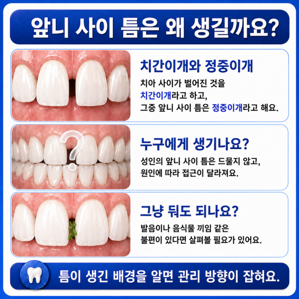 앞니 사이가 벌어져 보이는 이유는? - 설명 이미지 3