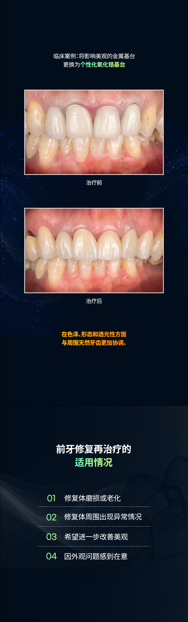 前牙修复 移动端图片