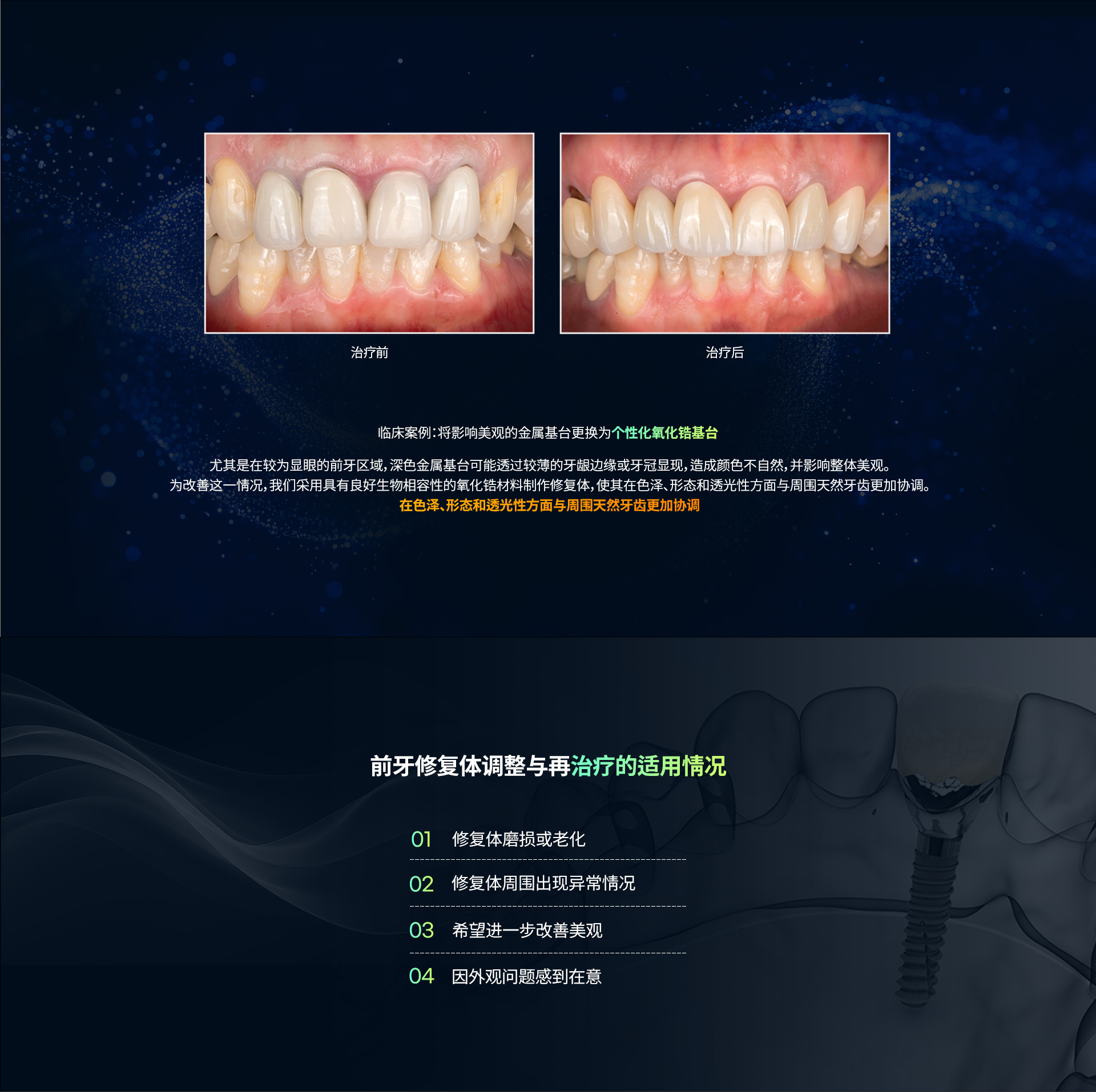 前牙修复 PC端图片