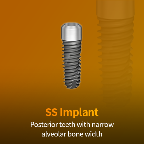SS Implant: implant fixture for posterior teeth with narrow alveolar bone width