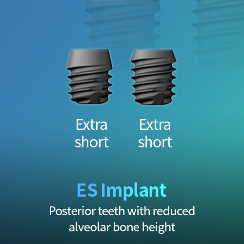 ES Implant: two extra short implant fixtures for posterior teeth with reduced alveolar bone height