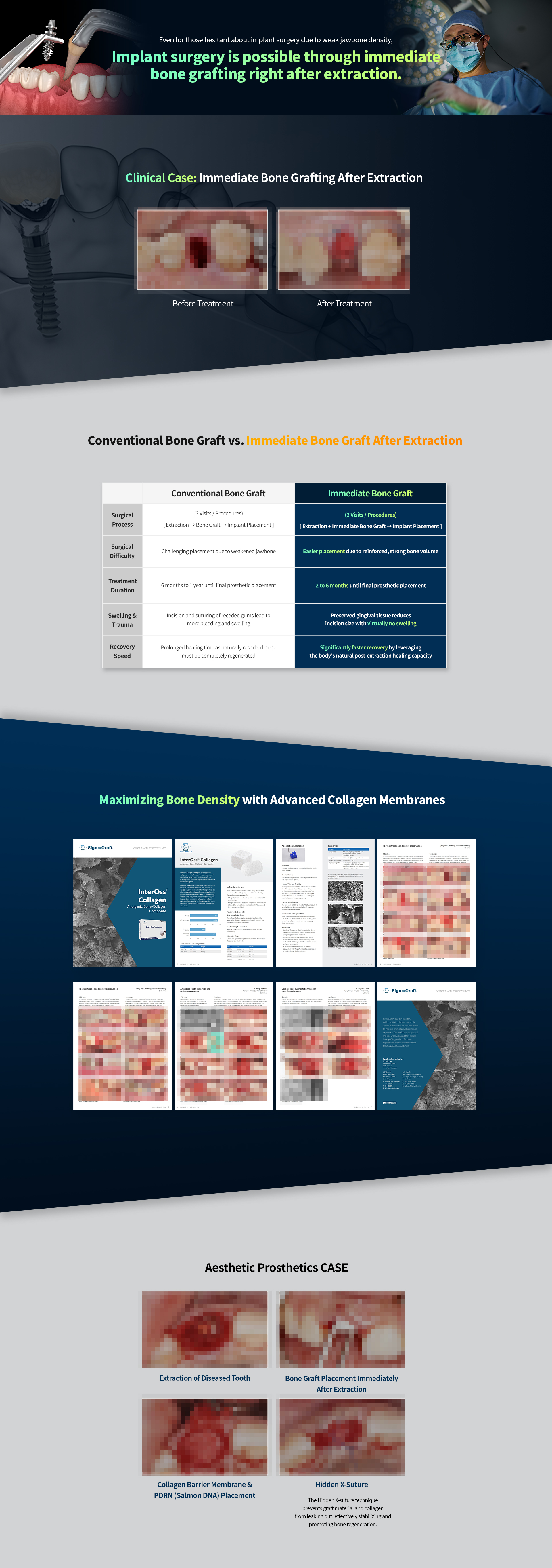 Immediate bone grafting after extraction versus conventional bone graft for implants
