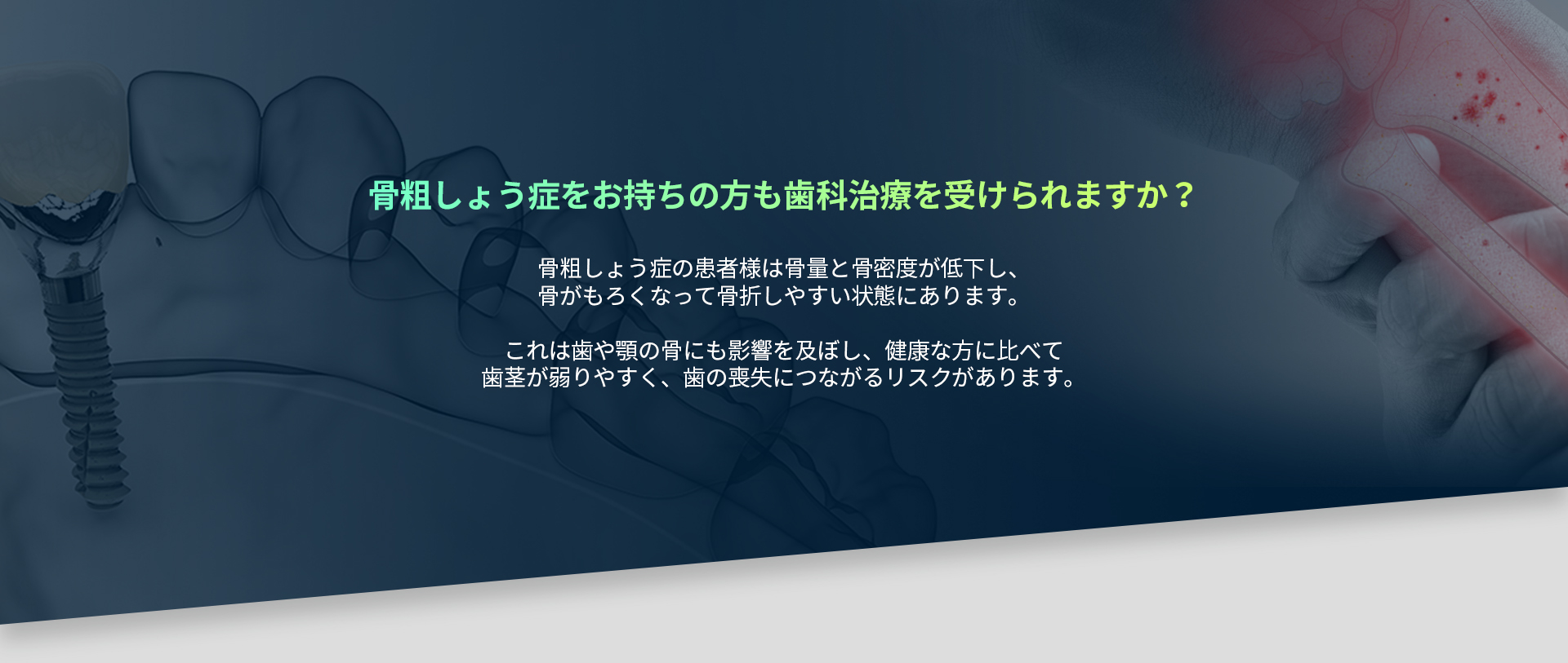 骨粗しょう症の方の歯科治療の可否と歯槽骨への影響のご案内