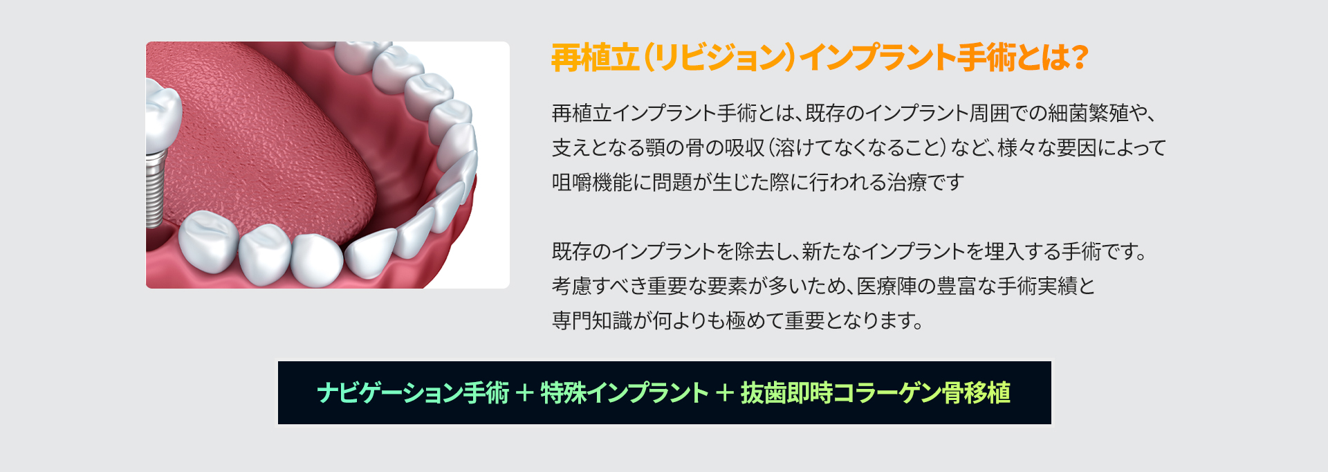 再植立(リビジョン)インプラント手術の紹介